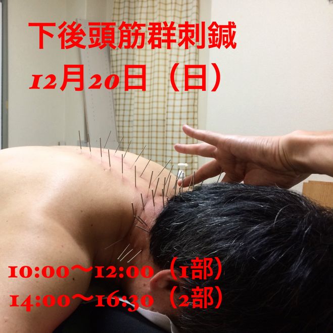 インナーマッスル刺鍼講座(下後頭筋群)