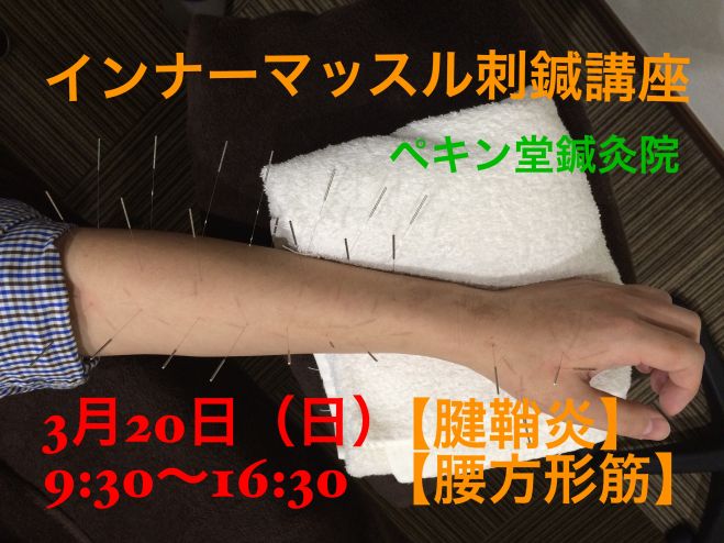 インナーマッスル刺鍼講座【腱鞘炎、腰方形筋】