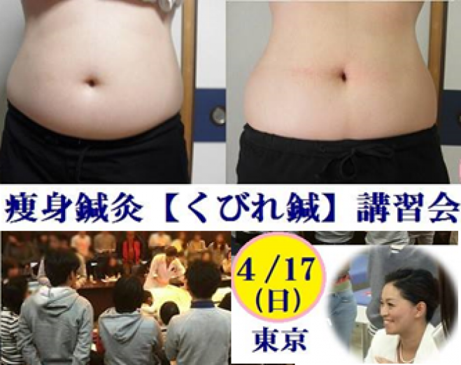 4/17開催!新たな美容鍼灸◆痩身鍼灸【くびれ鍼】東京講習会