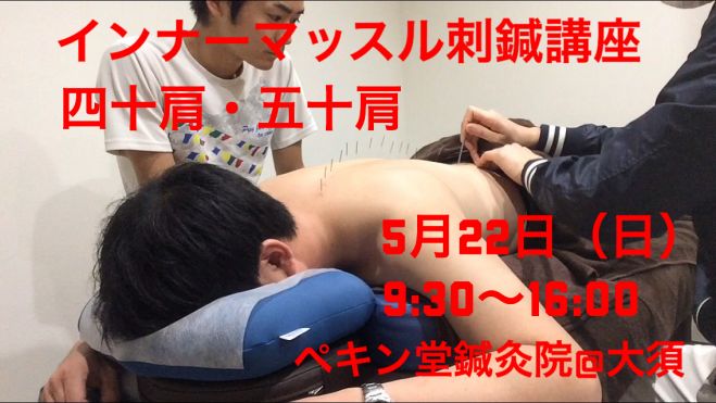 インナーマッスル刺鍼講座(五十肩)