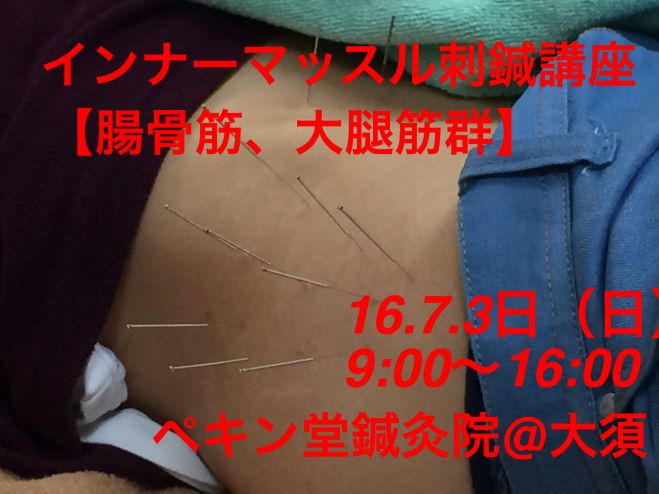 インナーマッスル刺鍼講座(腸骨筋、臀部の深刺し鍼)