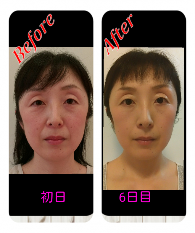 顔ヨガレッスン
