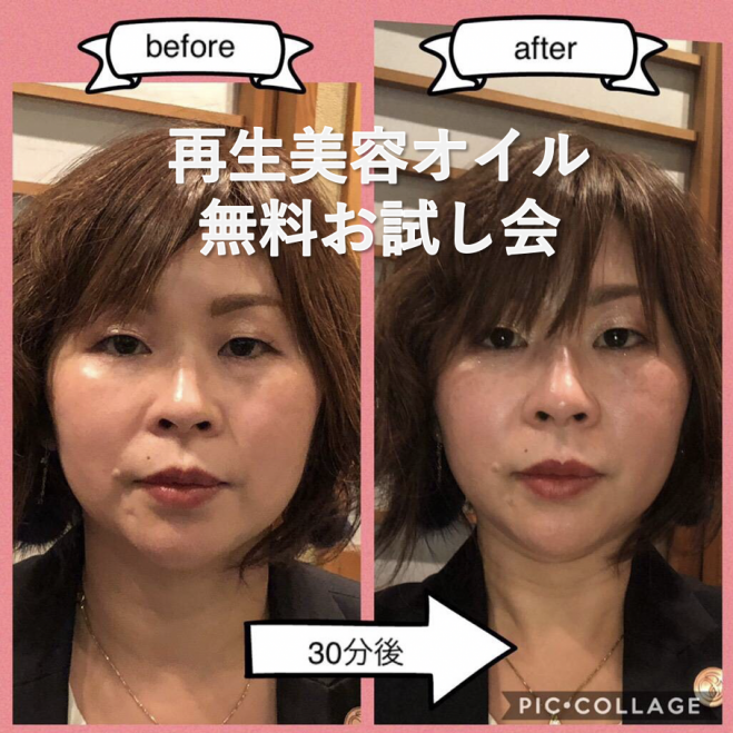話題の再生美容オイル 歳肌が若返る 再生美容オイルお試し会 19年1月18日 東京都 こくちーずプロ 話題の再生美容オイル 歳肌が若返る 再生美容オイルお試し会 19年1月18日 東京都 こくちーずプロ