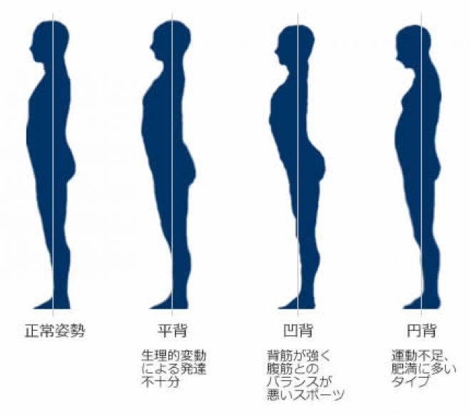 足の長さの違いがある セミナー 勉強会 イベント こくちーずプロ 足の長さの違いがある セミナー 勉強会 イベント こくちーずプロ