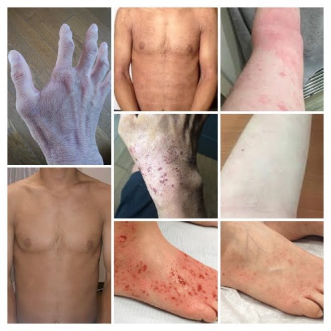 皮膚学 アトピー治療編 年3月7日 大阪府 こくちーずプロ