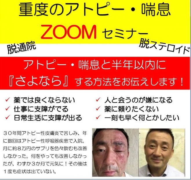 アトピー セミナー 勉強会 イベント こくちーずプロ